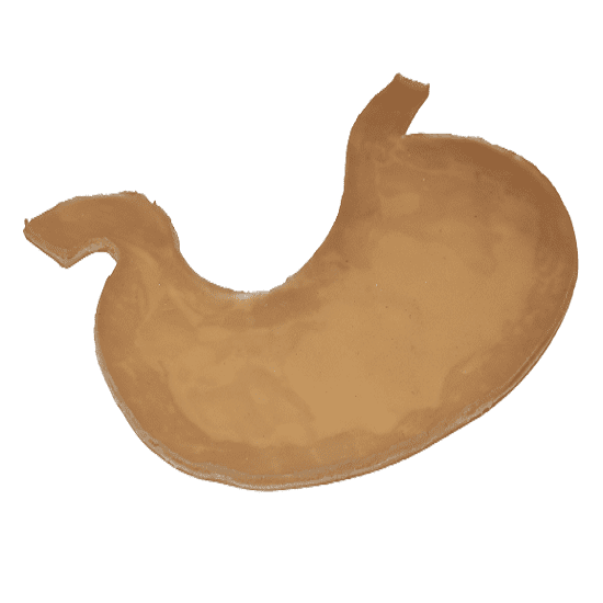 Bariatric Stapling Trainer