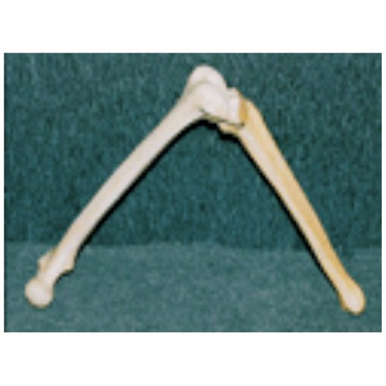 Saw Bones for arthroplasty training – (Femur and Tibia)