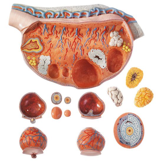 Ovary Model
