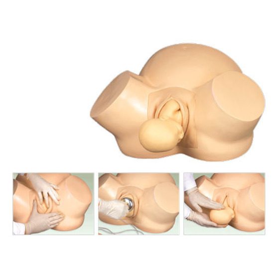 Vacuum Delivery Mode Models