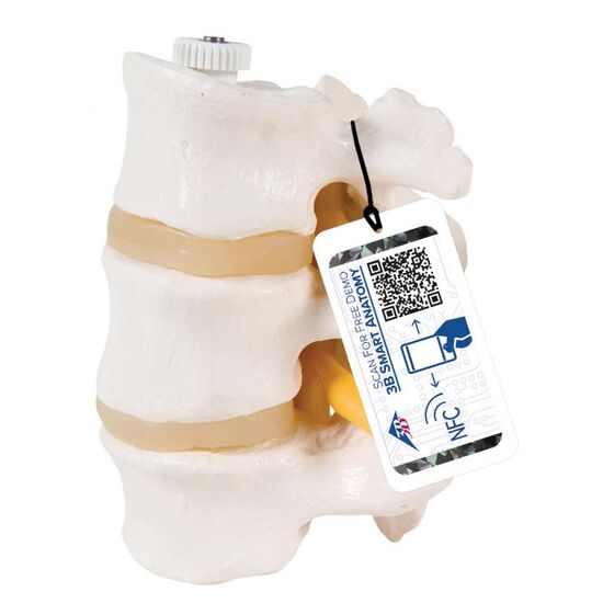 3 Human Lumbar Vertebrae, Flexibly Mounted – 3B Smart Anatomy