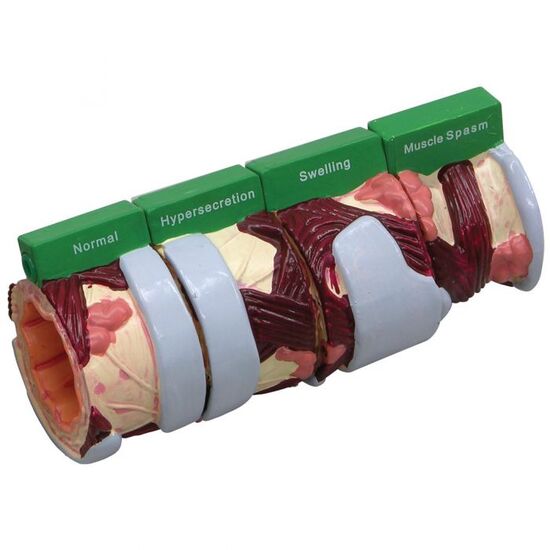 4-Piece Bronchus Model
