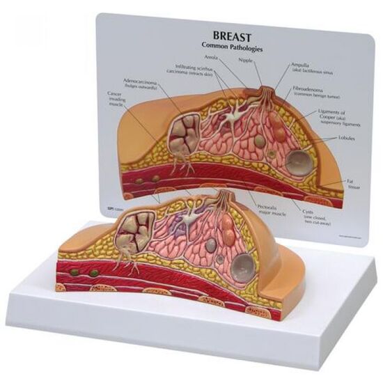 Breast Cross-Section Model