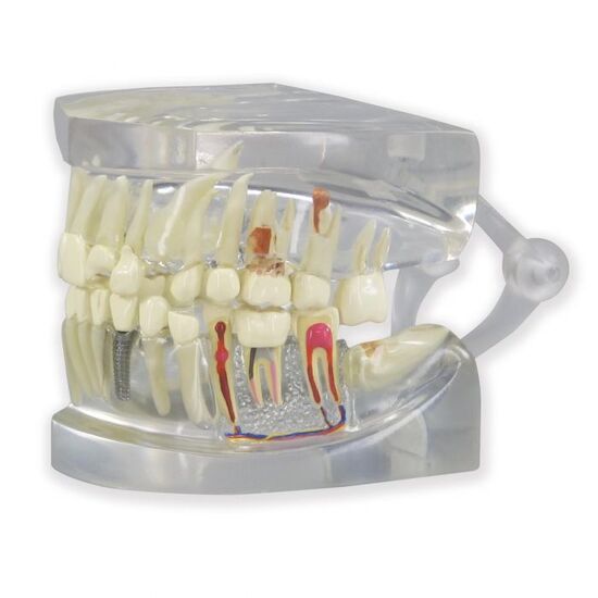 Clear Human Jaw with teeth model