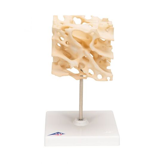Human Cancellous Bone Model, Enlarged 100 times – 3B Smart Anatomy