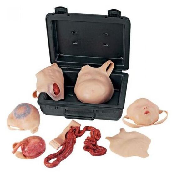 Neonatal Wound Kit