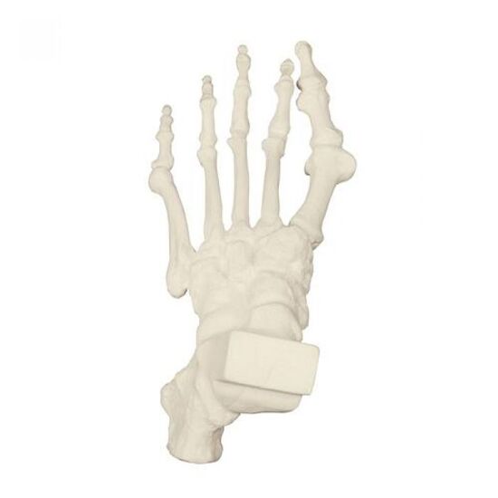 ORTHObones Premium Foot with hammer toes, bunions and heel