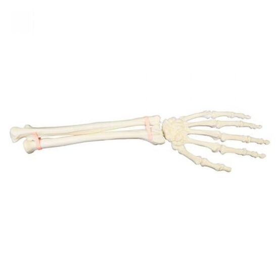 ORTHObones Premium Hand and Forearm, left