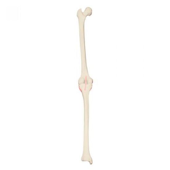 ORTHObones Premium Left Knee