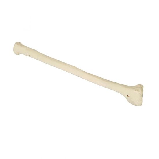 ORTHObones Premium Left Radius