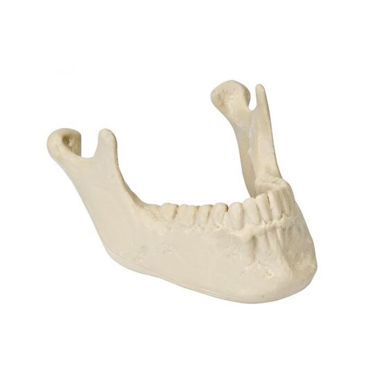 ORTHObones Premium Mandible with Teeth
