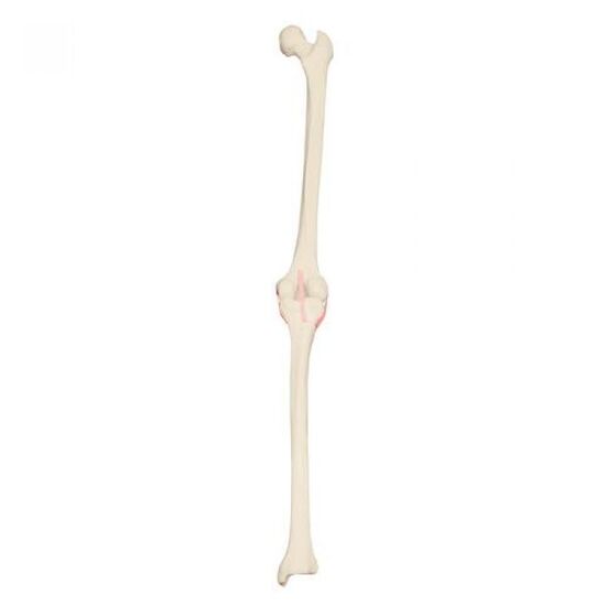 ORTHObones Premium Right knee