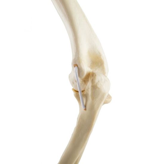 ORTHObones Standard Elbow elastic bands l