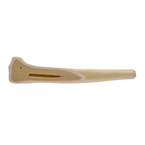 ORTHObones Standard Femur, right
