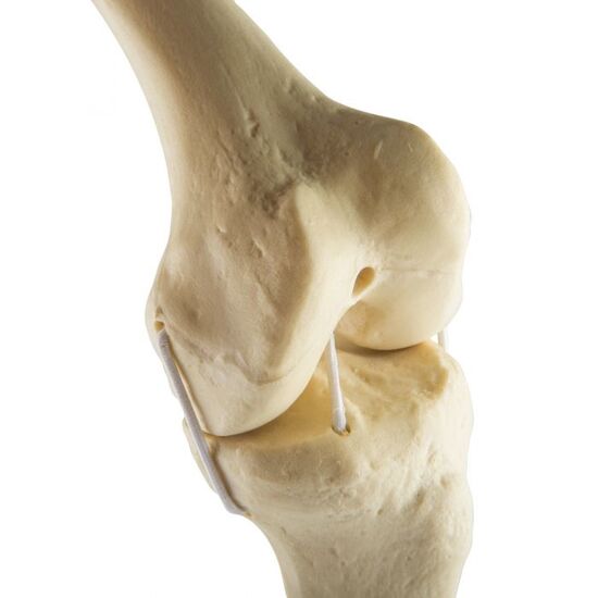 ORTHObones Standard Knee left