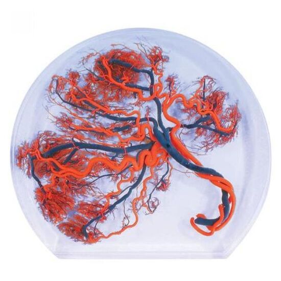 Placenta Model