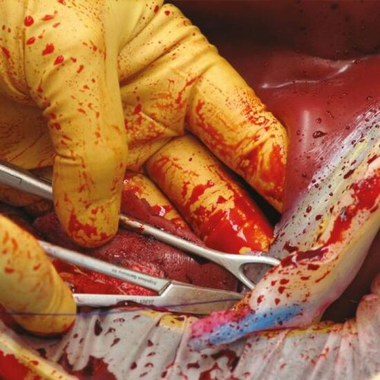 Postpartum Hemorrhage (PPH) Control Trainer – C-Celia