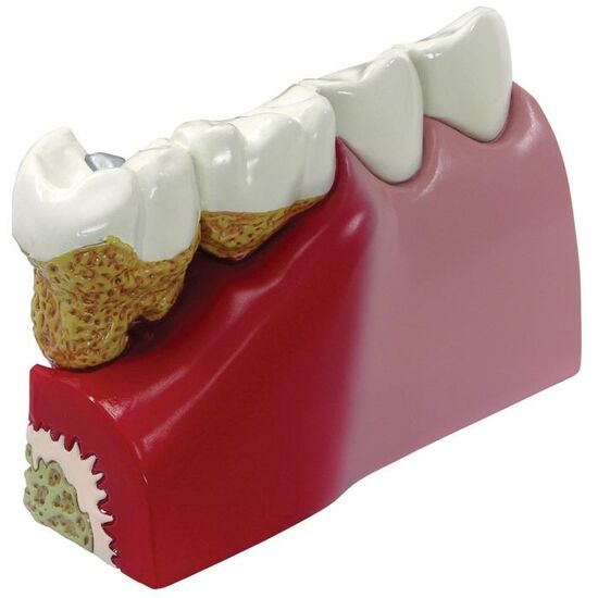 Teeth Model