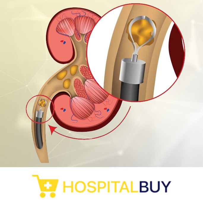 Use of Minimal Access Surgery in Urology: Current & Future Perspective