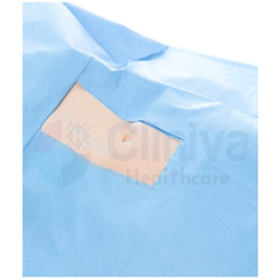 Normal Delivery Drapes