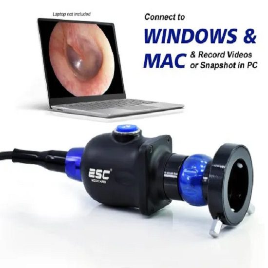 Portable HD USB Endoscopy Camera for ENT for Laptop PC