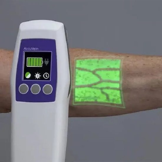 Vein Locator